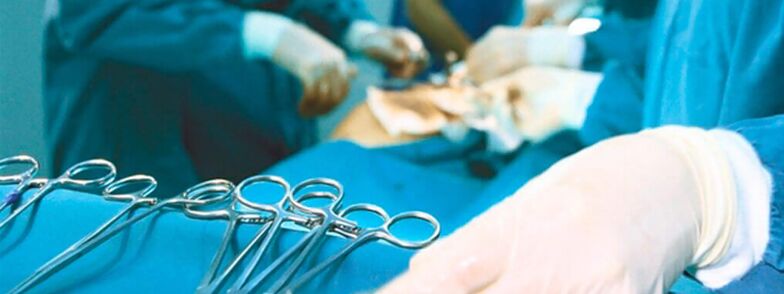 Chirurgie de mărire a penisului efectuată de un chirurg