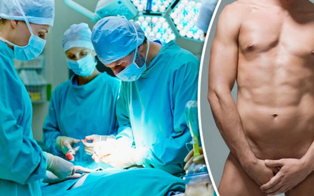 chirurgie de mărire a penisului