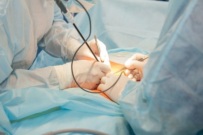 chirurgie de mărire a penisului